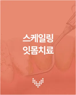 스케일링 잇몸치료