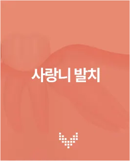 사랑니 발치