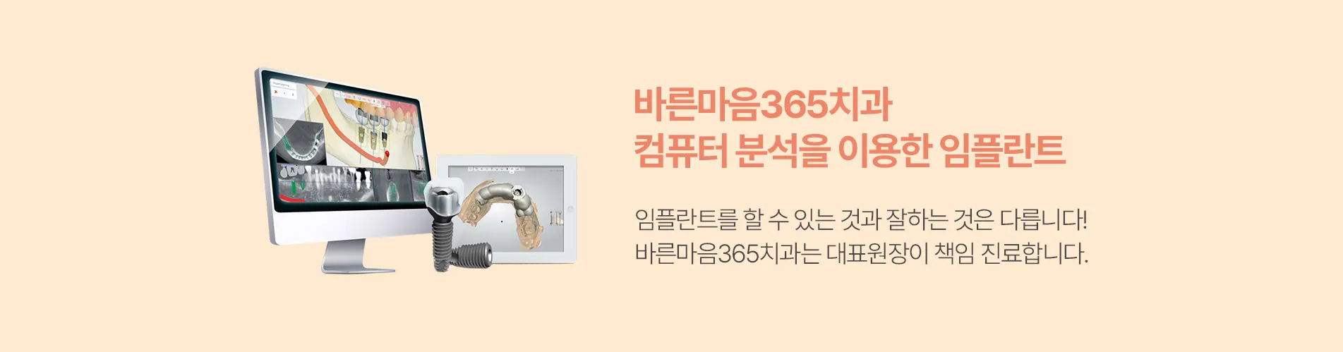 바른마음365치과 컴퓨터 분석을 이용한 임플란트