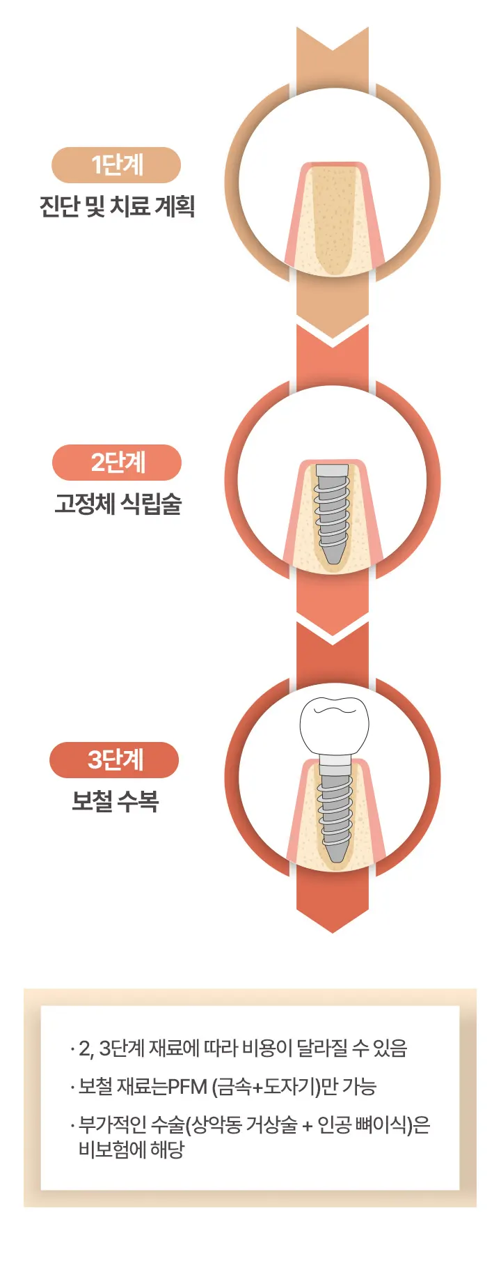 진단 및 치료 계획 > 고정체 식립술 > 보철 수복