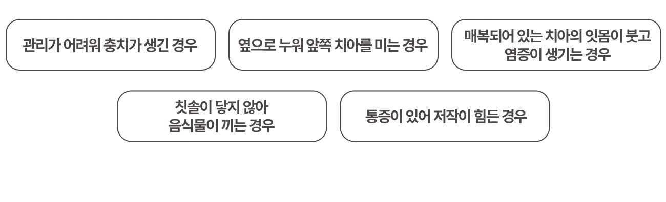 사랑니 발치가 필요한 경우